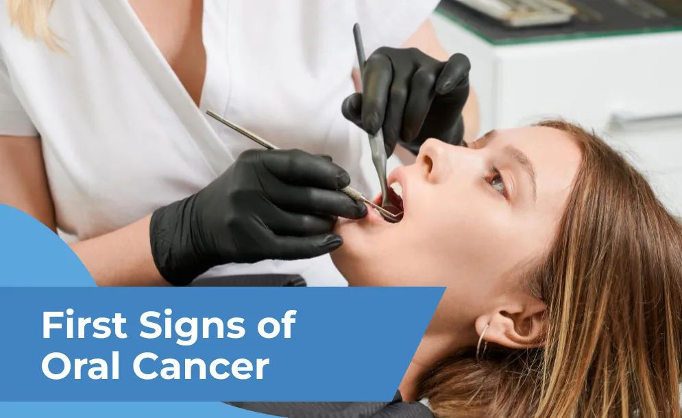 First Signs of Oral Cancer