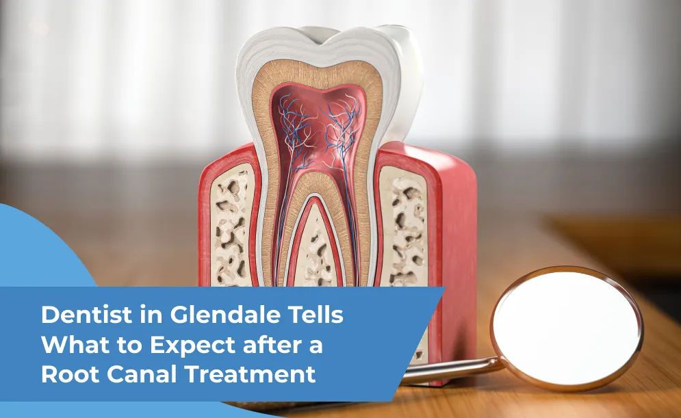 Dentist in Glendale Tells What to Expect after a Root Canal Treatment