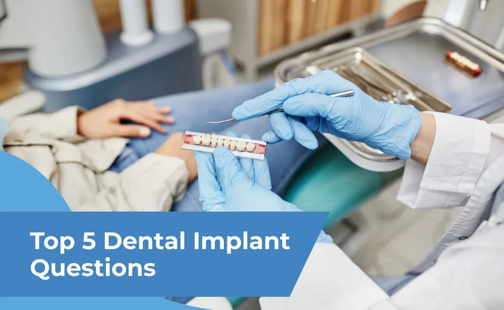Top 5 Dental Implant Questions