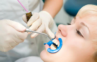 Dental Sealants Simi Valley
