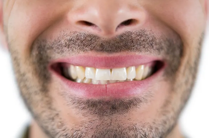 Does a Missing Tooth Need to Be Replaced?