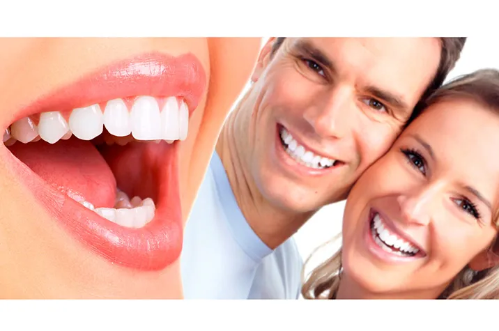 Fast Smile Makeovers for Special Events