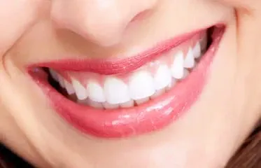 How to Have No Teeth Problems During the Holidays?