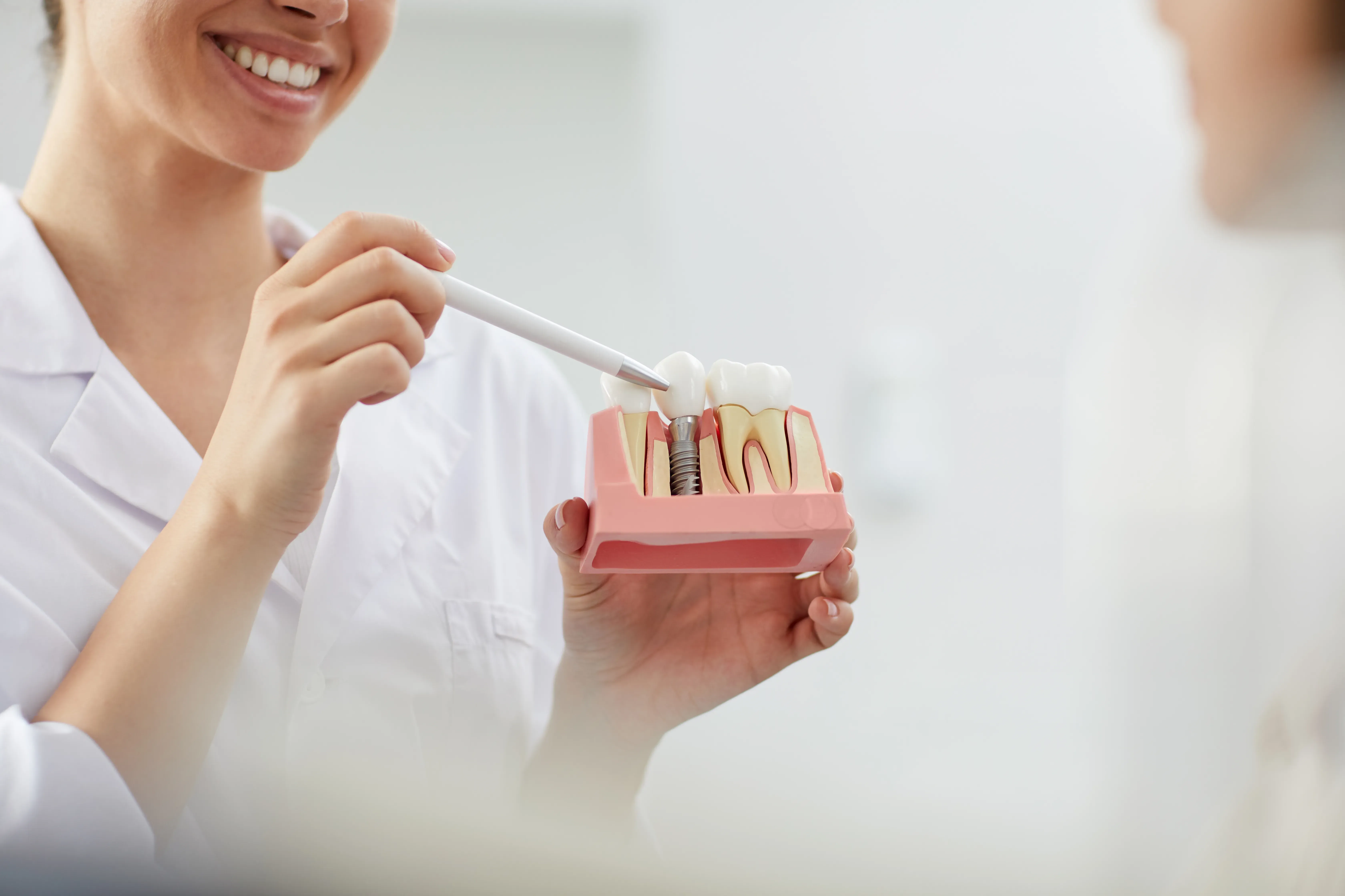 Elevate Your Smile Aesthetics: 4 Reasons to Choose Dental Implants