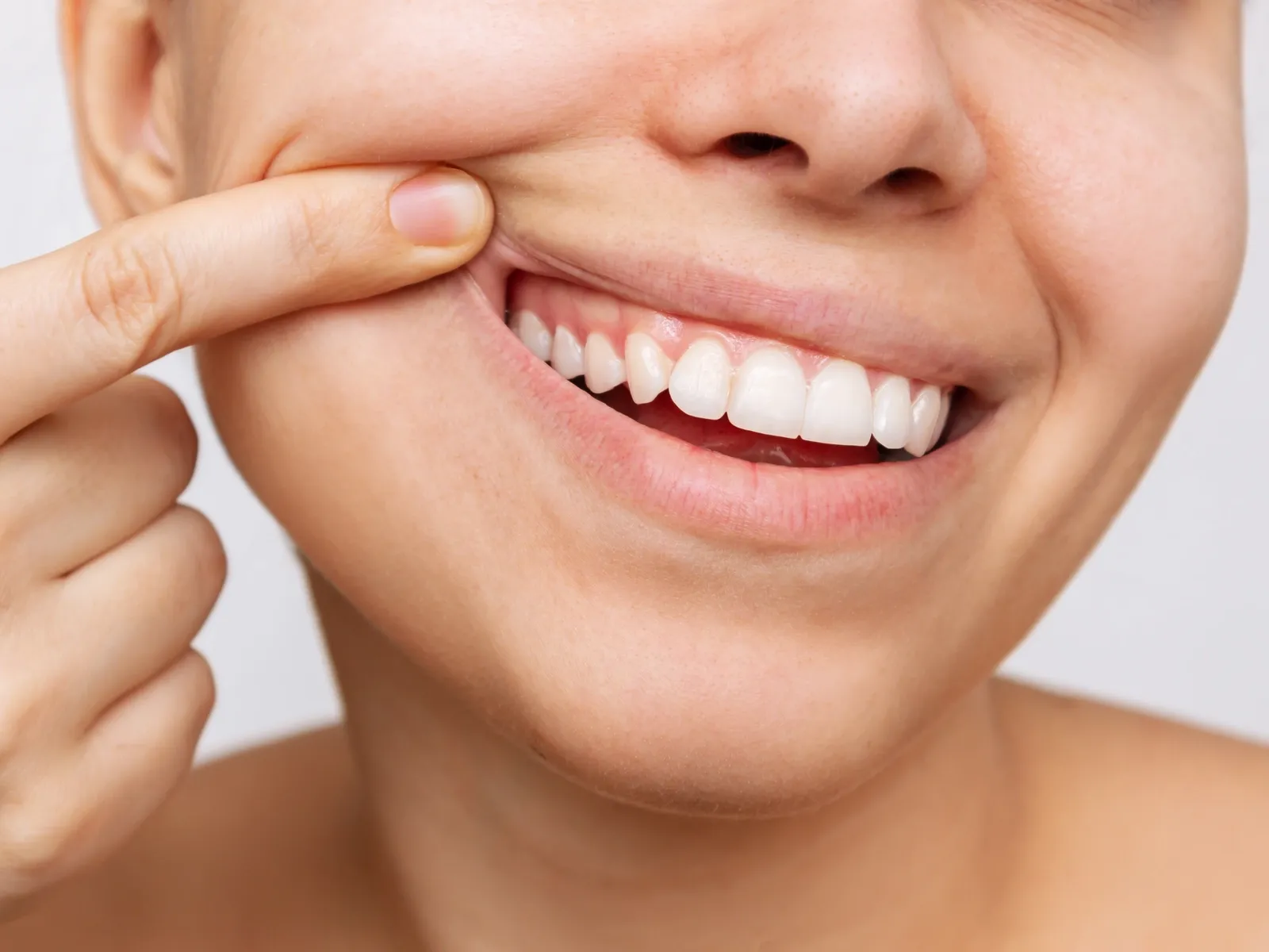 Gingivoplasty