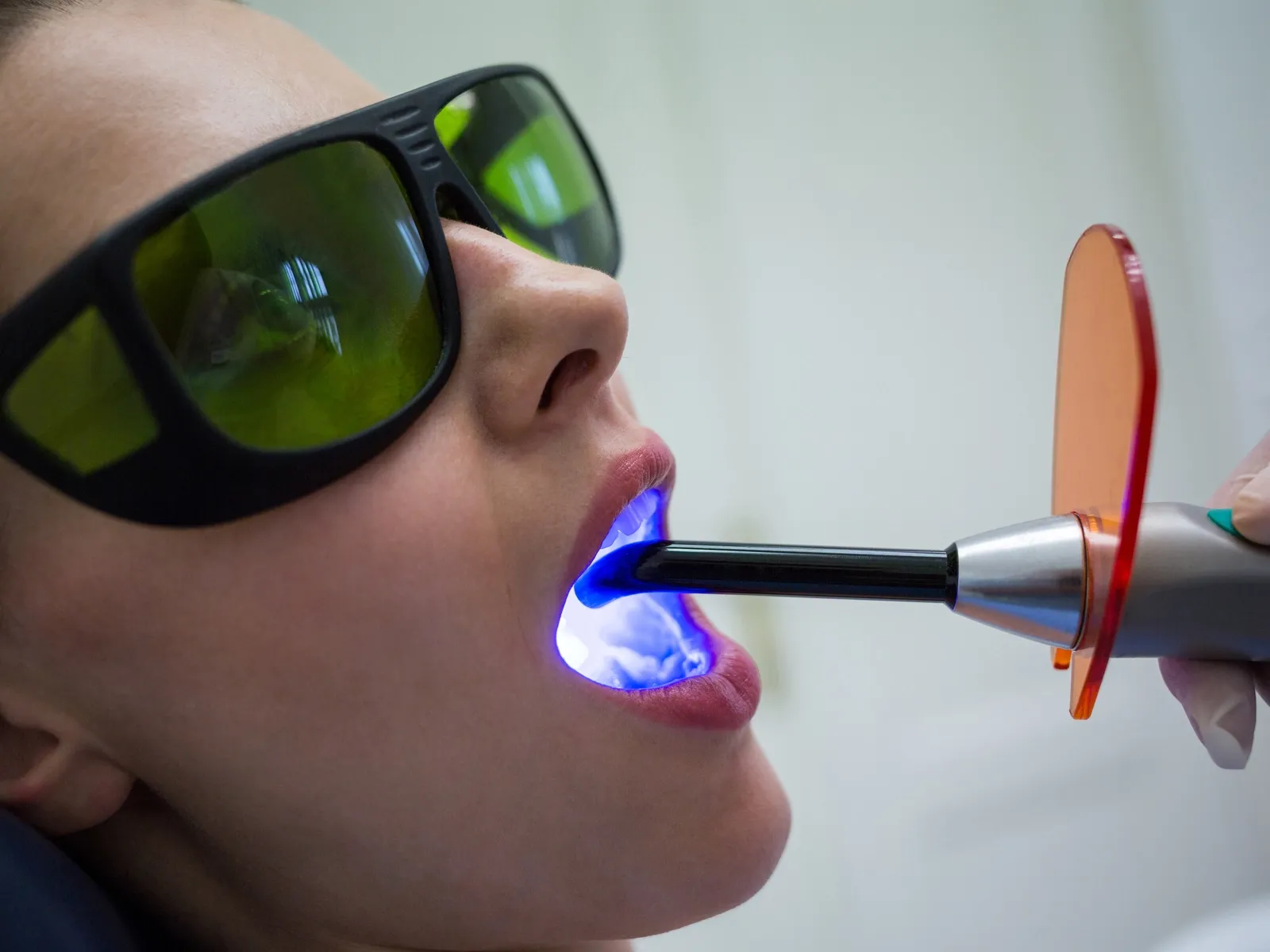 Laser for Gingival Therapy in Simi Valley
