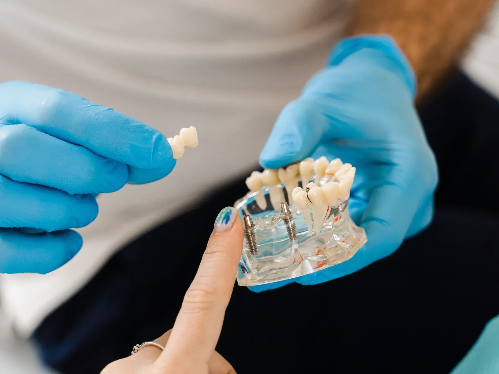Dental Implants Can Boost Your Oral and Overall Health