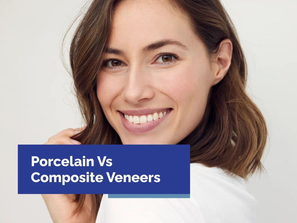 Porcelain Vs Composite Veneers