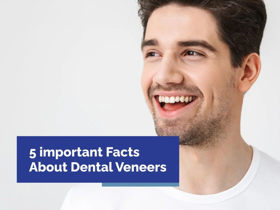 5 Important Facts About Dental Veneers You Need to Know