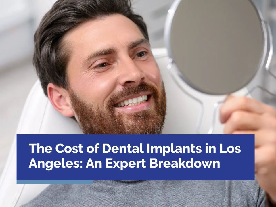 The Cost of Dental Implants in Los Angeles: An Expert Breakdown