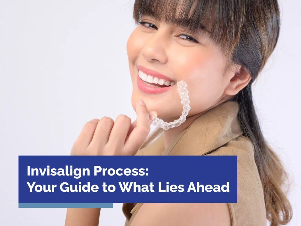 Invisalign Process: Your Guide to What Lies Ahead