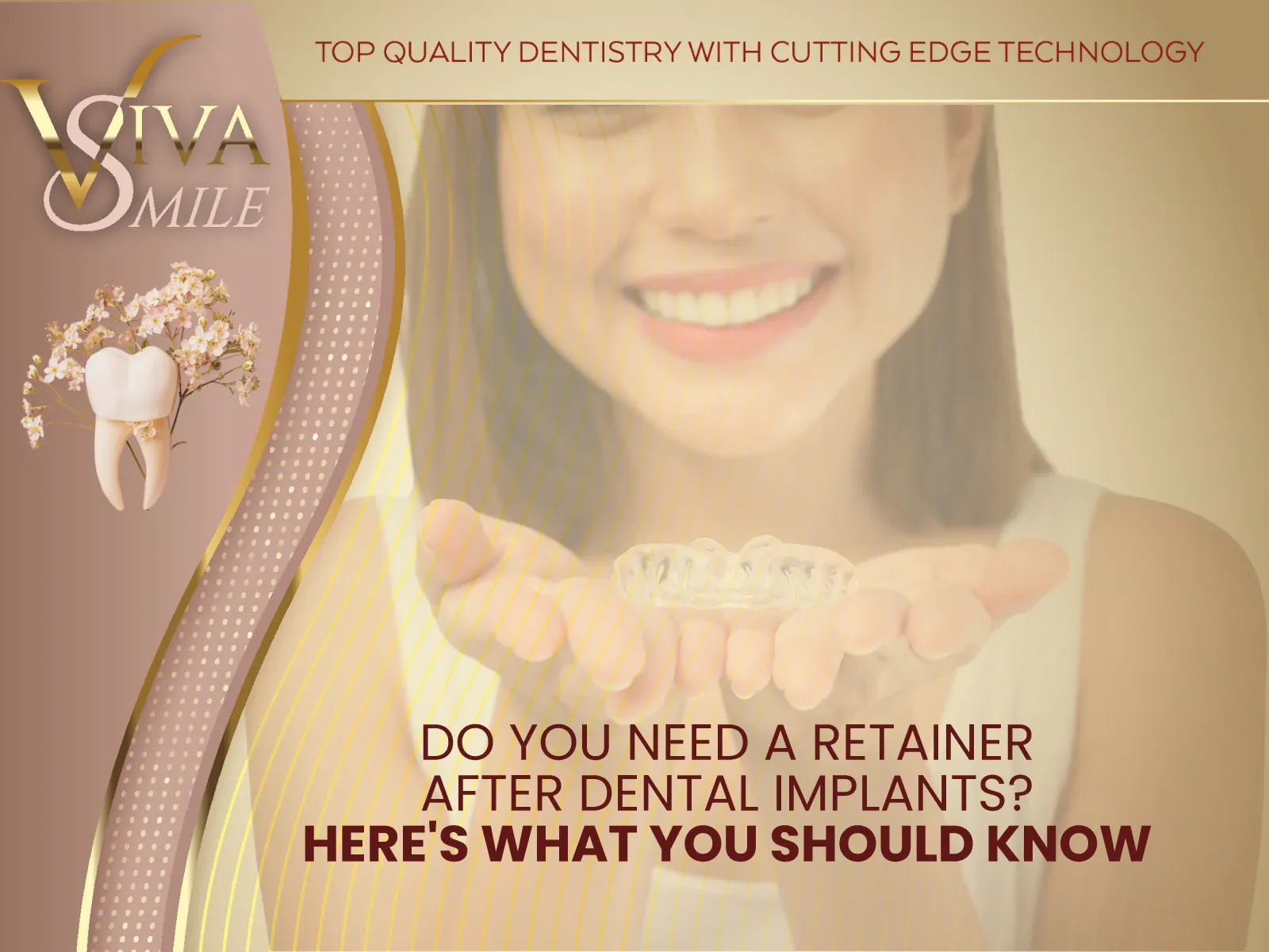 Do You Need a Retainer After Dental Implants? Here's What You Should Know