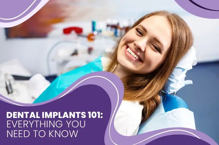Dental Implants 101: Everything You Need to Know