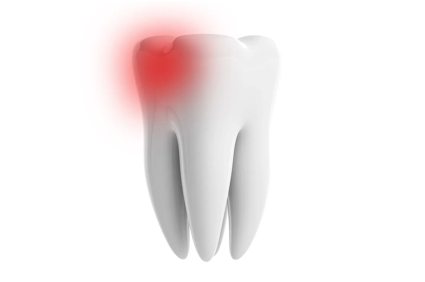 Root Canal Therapy - Endodontics in Pasadena Simi Valley