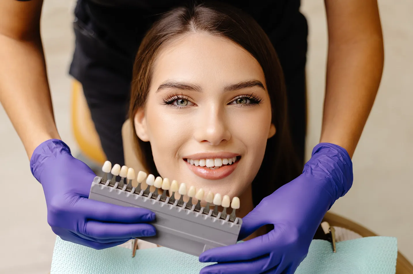 Porcelain Veneers in Pasadena Simi Valley