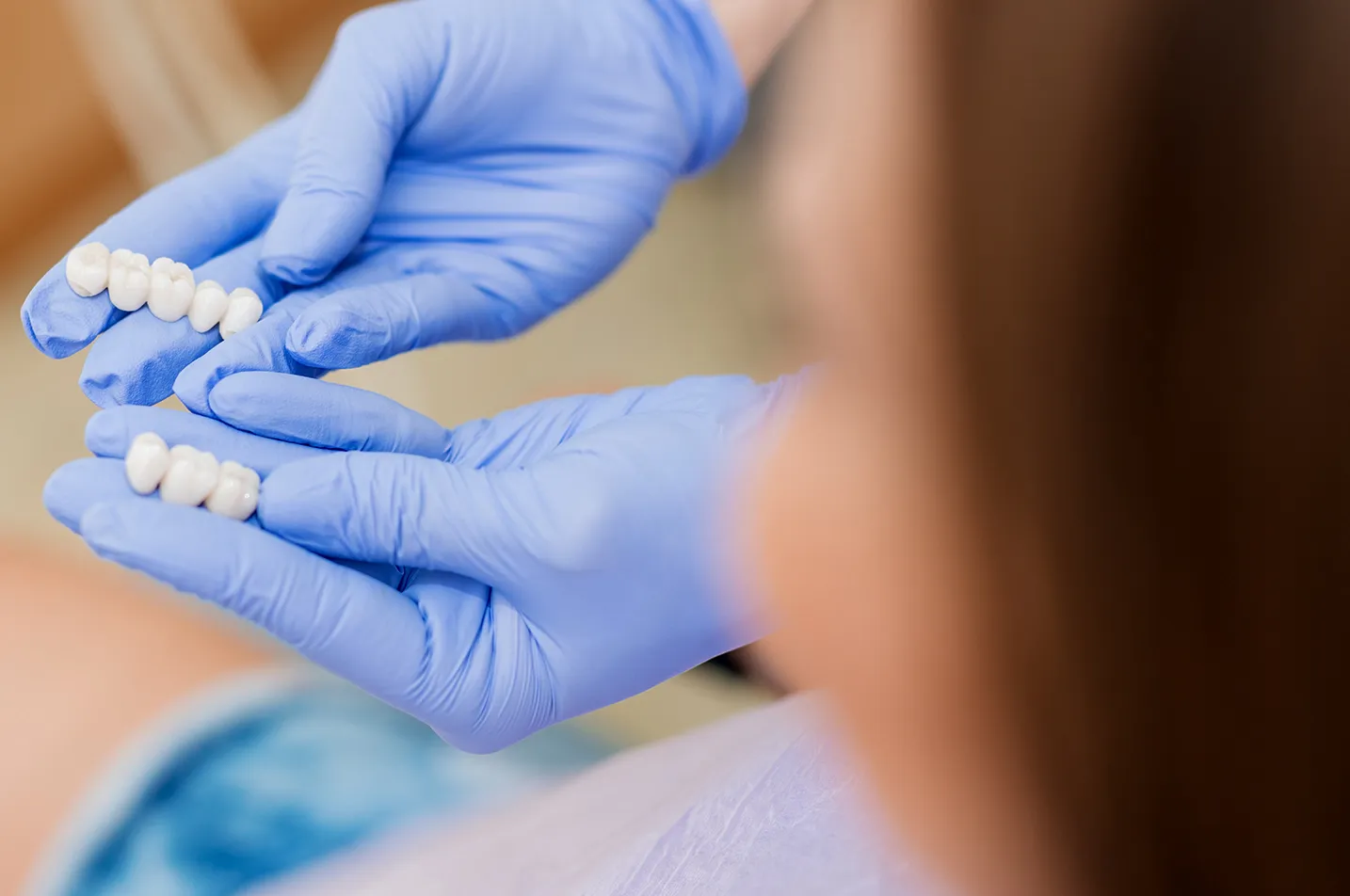 Porcelain Inlays and Onlays Simi Valley