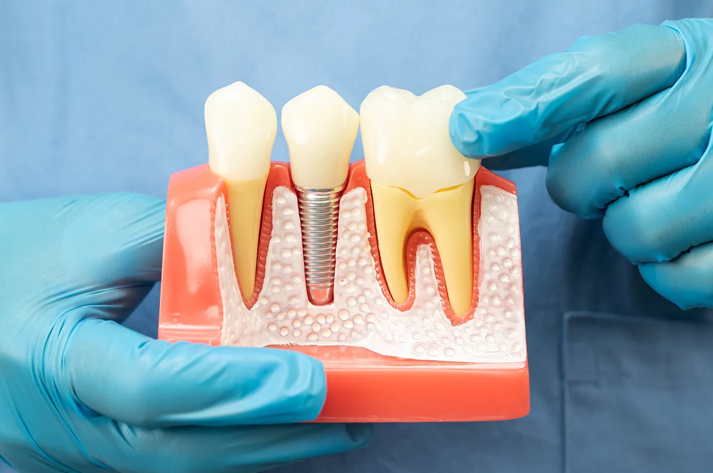 Exams and Cleanings in Pasadena Simi Valley