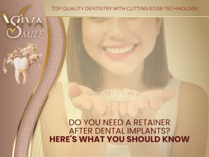 Do You Need a Retainer After Dental Implants? Here's What You Should Know