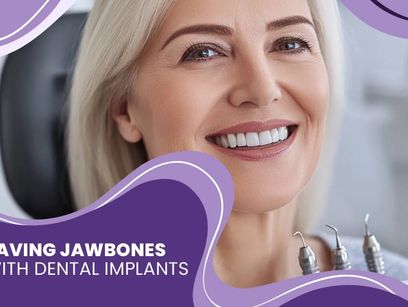 Saving Jawbones with Dental Implants